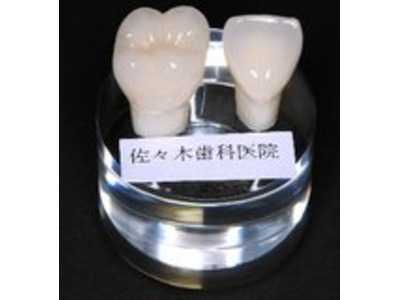 佐々木歯科医院の写真2枚目:ホワイトニングや審美にも力を入れています