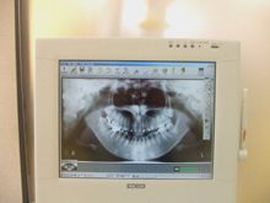 荒川歯科医院（歯科衛生士の求人）の写真2枚目：患者様へわかりやすい説明を心がけています。