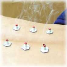 やなおか鍼灸整骨院の写真6枚目:使い捨てのディスポ鍼を使用しております。