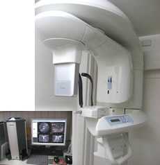 沢木歯科医院の写真9枚目:歯科用CT装置です。被ばく量の少ない装置を導入しています!