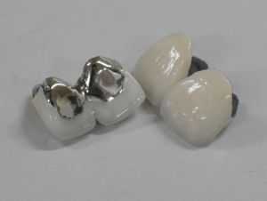 株式会社デンテックの写真3枚目:幅広く技工を学ぶことができる環境です