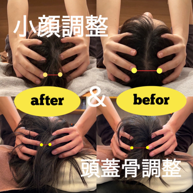 KARADA8鍼灸整骨院の写真2枚目：