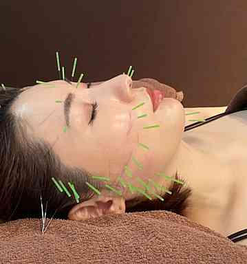 大阪美容鍼ledia　堀江店（鍼灸師の求人）の写真8枚目：