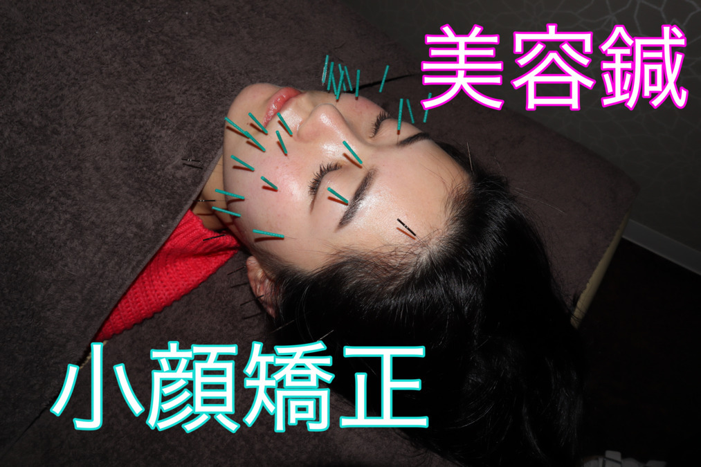 SKY鍼灸整骨院の写真3枚目：
