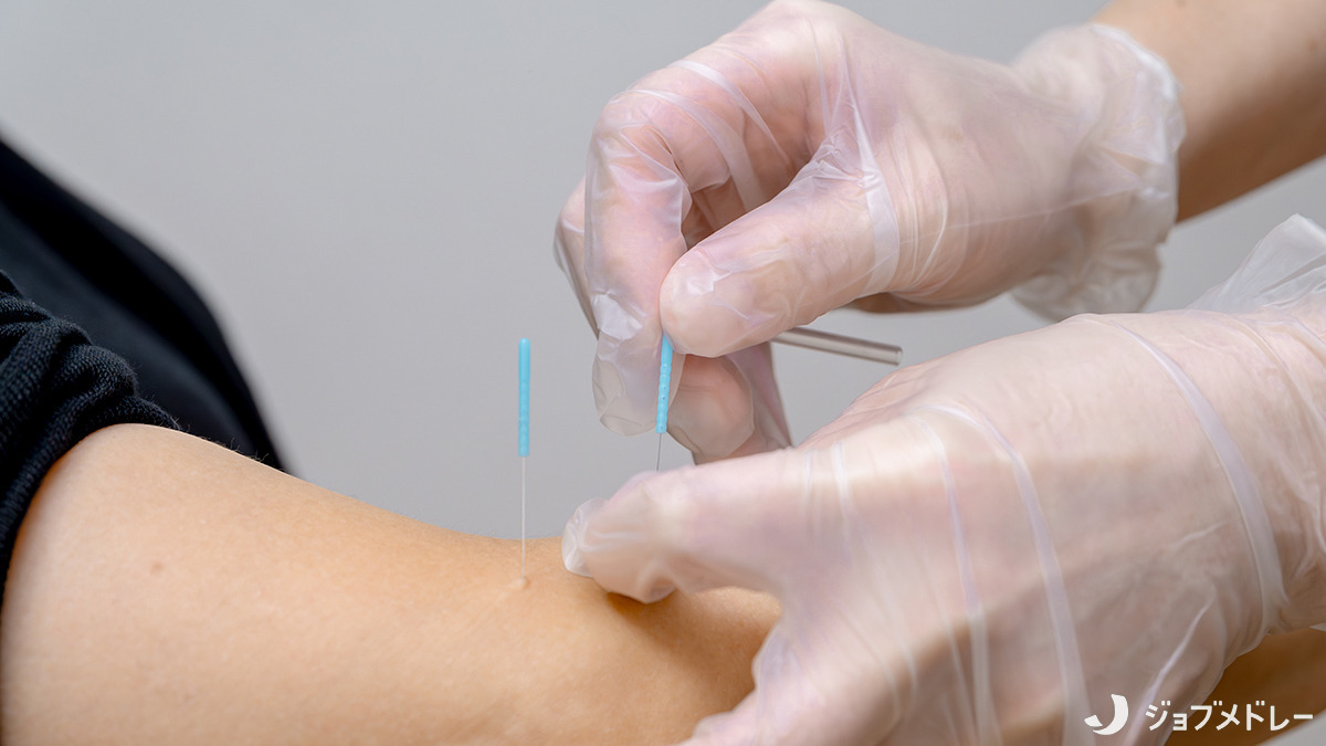 フレアス在宅マッサージ綾瀬施術所（あん摩マッサージ指圧師の求人）の写真5枚目：鍼灸にも対応しています