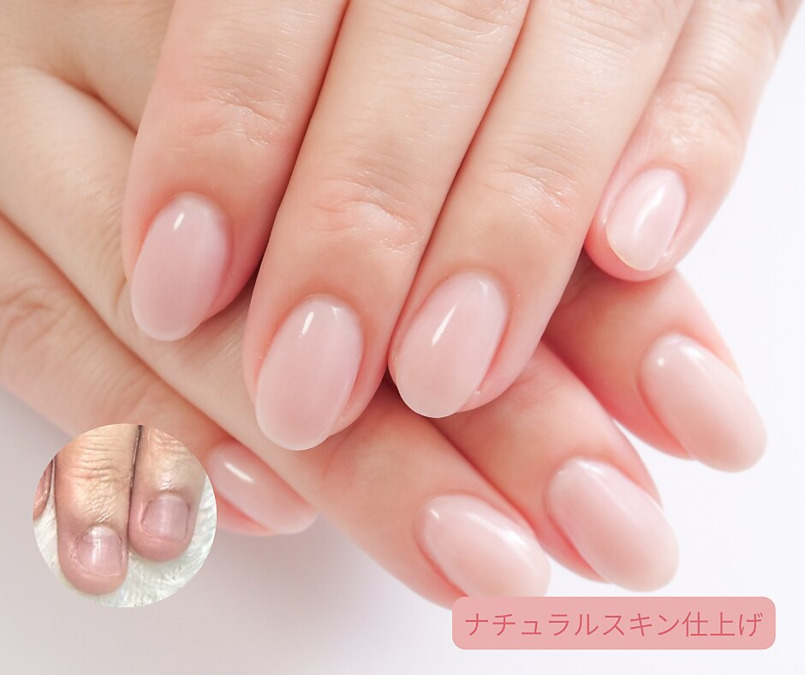 深爪矯正爪悩み専門店グレースレディ 大阪店（ネイリストの求人）の写真4枚目：