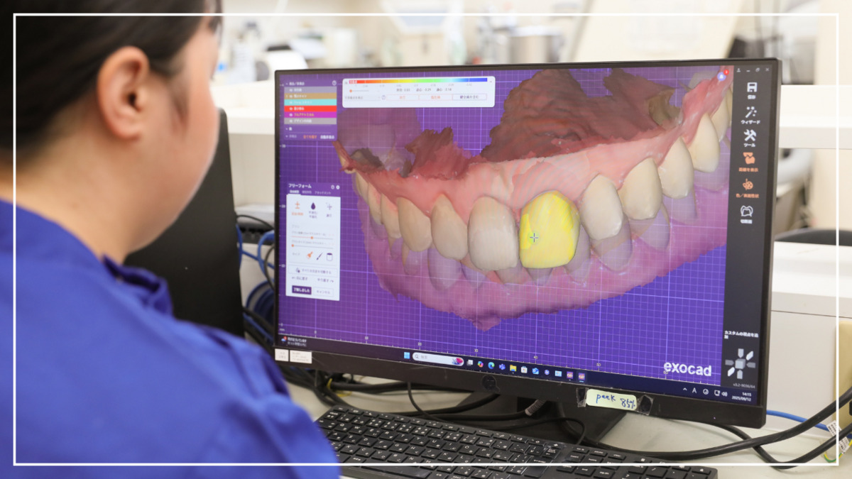 株式会社T’s(歯科技工士の求人)の写真3枚目: