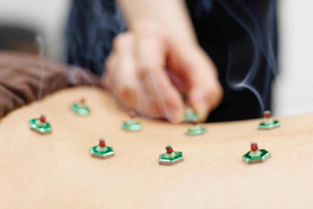 神門鍼灸整骨院 甲東園院（鍼灸師の求人）の写真3枚目：