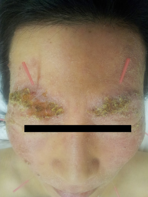 VE&BI治療院(鍼灸師の求人)の写真11枚目: