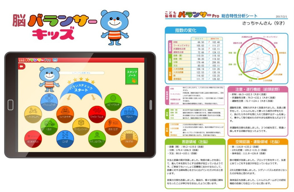 児童発達支援/放課後等デイサービス Hagumi kids（はぐみキッズ）【2025年12月01日オープン予定】（保育士の求人）の写真16枚目：脳バランサーキッズ