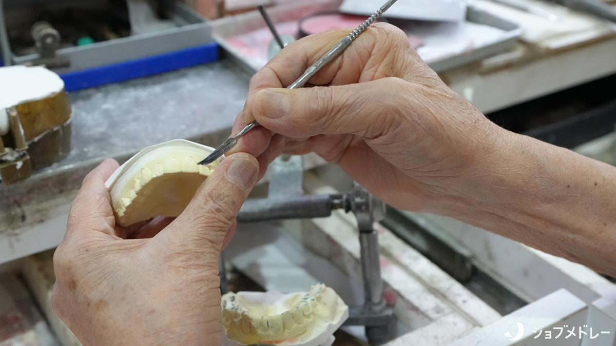 医療法人社団 樹正会 丸山歯科医院の写真19枚目:患者様それぞれのお口の状態に合わせた技工物を作成しています