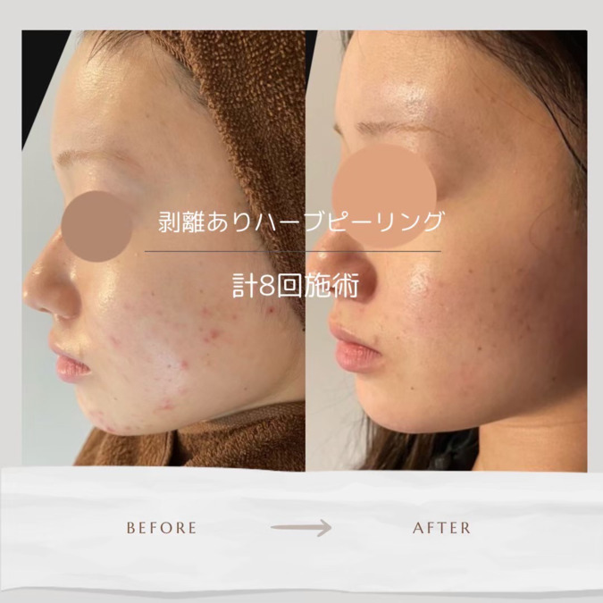 Life Salon 恵比寿(エステティシャン/セラピストの求人)の写真2枚目: