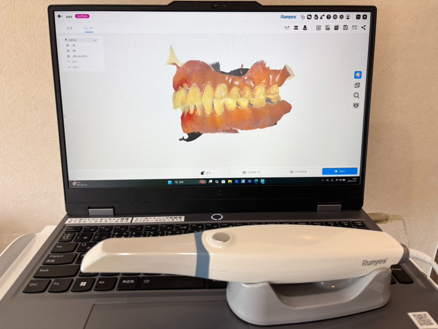 ウエダデンタルクリニックの写真5枚目:口腔内スキャナー