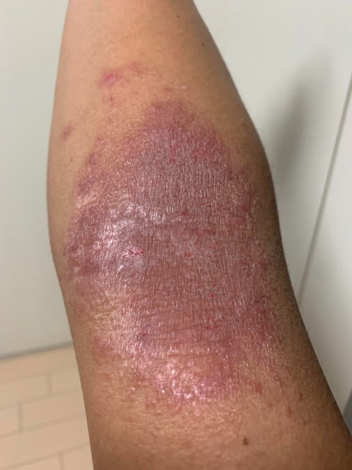 VE＆BI治療院（鍼灸師の求人）の写真14枚目：