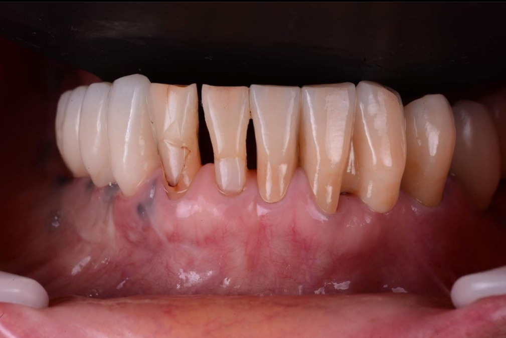 株式会社Lea ceramic worksの写真5枚目：