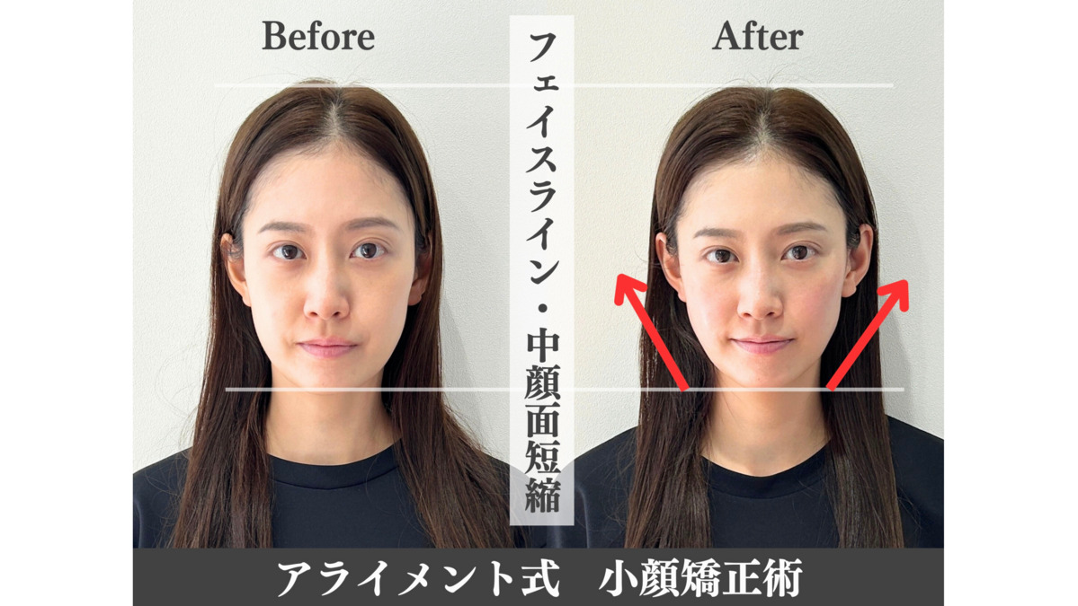 美容整体 AlignmentTOKYO 表参道【2024年11月オープン】（鍼灸師の求人）の写真3枚目：