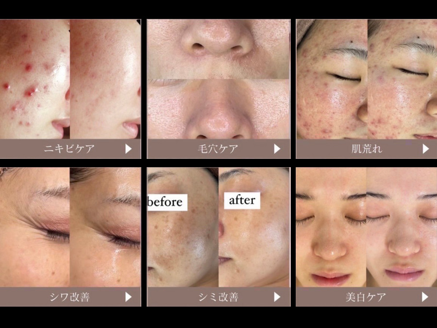 WHITE AQUA高槻店（エステティシャン/セラピストの求人）の写真4枚目：