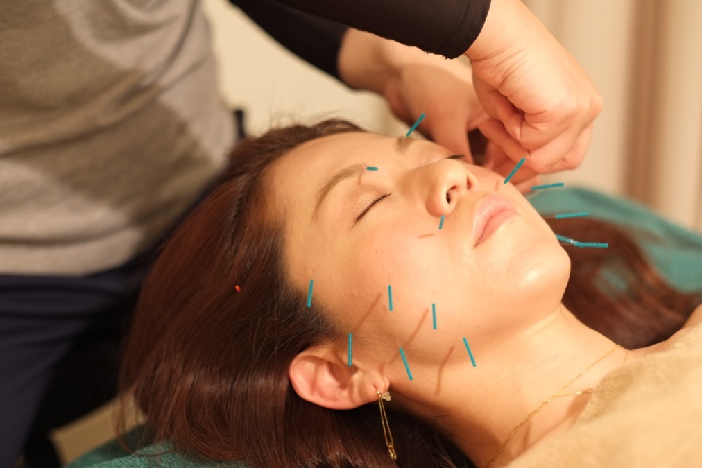 健志接骨院（鍼灸師の求人）の写真6枚目：