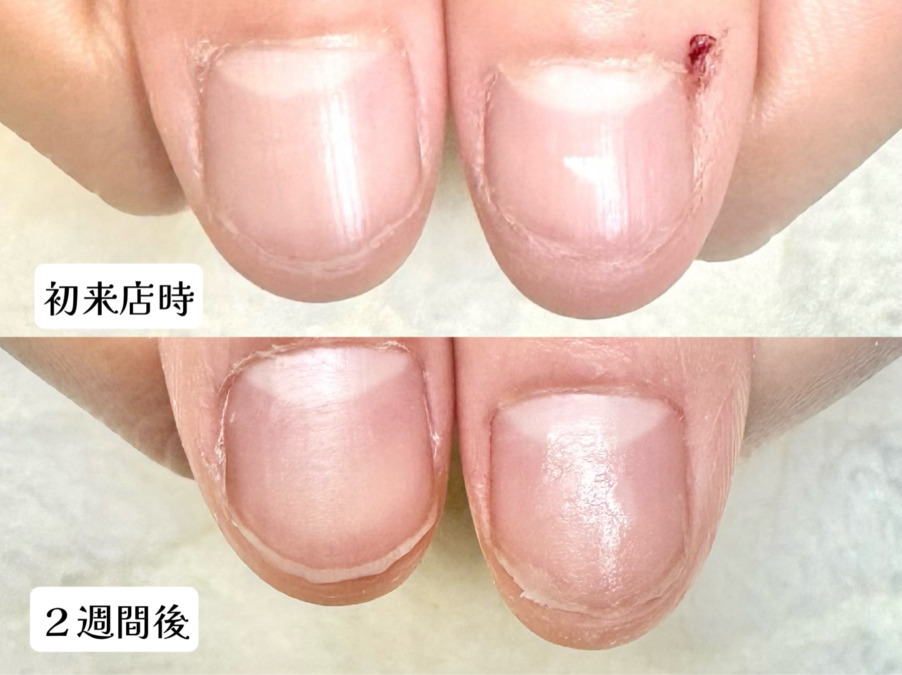 深爪矯正爪悩み専門店　グラシナ　烏丸店【2025年05月11日オープン】（ネイリストの求人）の写真2枚目：