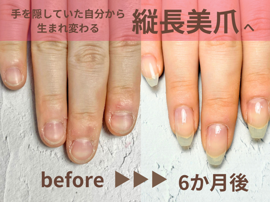 深爪矯正・自爪育成専門サロンNatulea(ネイリストの求人)の写真3枚目: