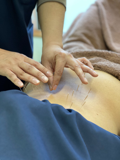 くにさだ鍼灸整骨院（鍼灸師の求人）の写真8枚目：当院は皆様をはり灸で改善に導きます。