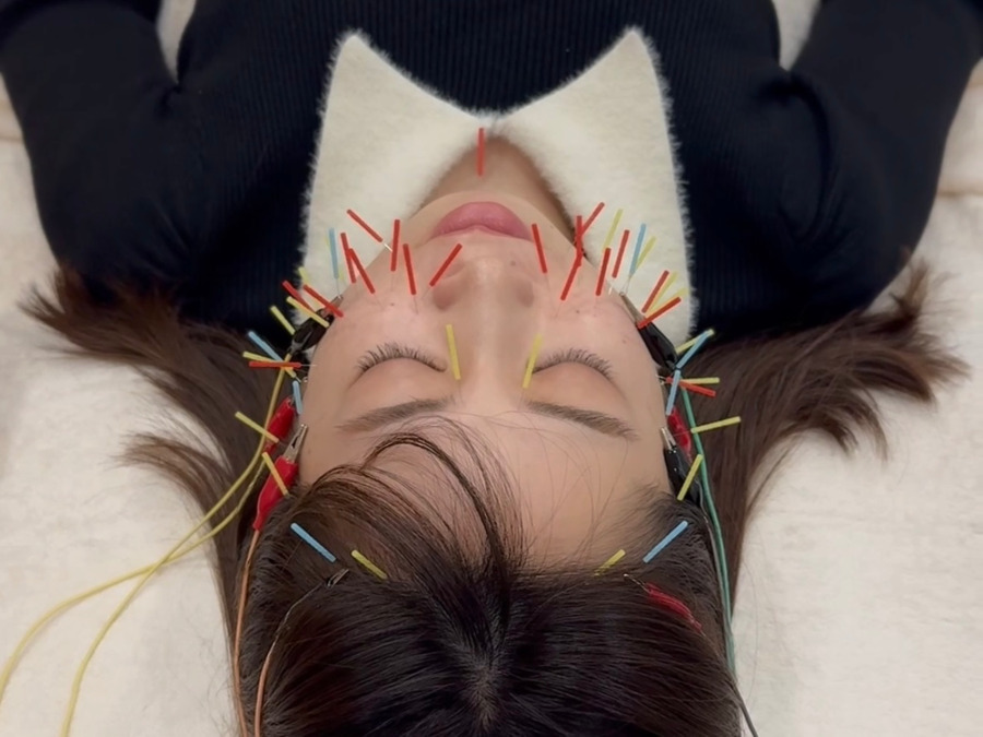 美容鍼&INDIBA SALON Miの写真