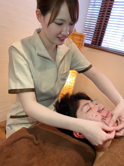 きくち鍼灸整骨院の写真7枚目：鍼灸治療、美容鍼も好評で多数の鍼灸師が活躍しています。