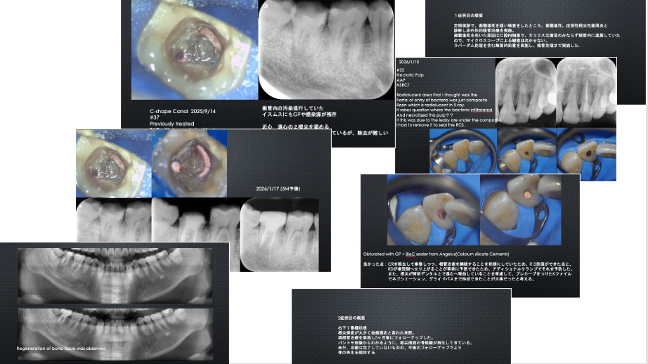 五反田エヌ・エイ歯科(歯科医師の求人)の写真4枚目:カンファレンス資料です。