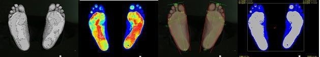 MIO鍼灸整骨院の写真2枚目：専用の機器で足底の状況をみます