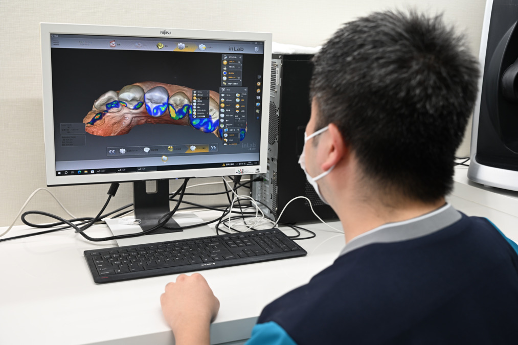 星野歯科クリニック（歯科医師の求人）の写真19枚目：最新のデジタル技術を活用し、正確で美しい技工物を製作。