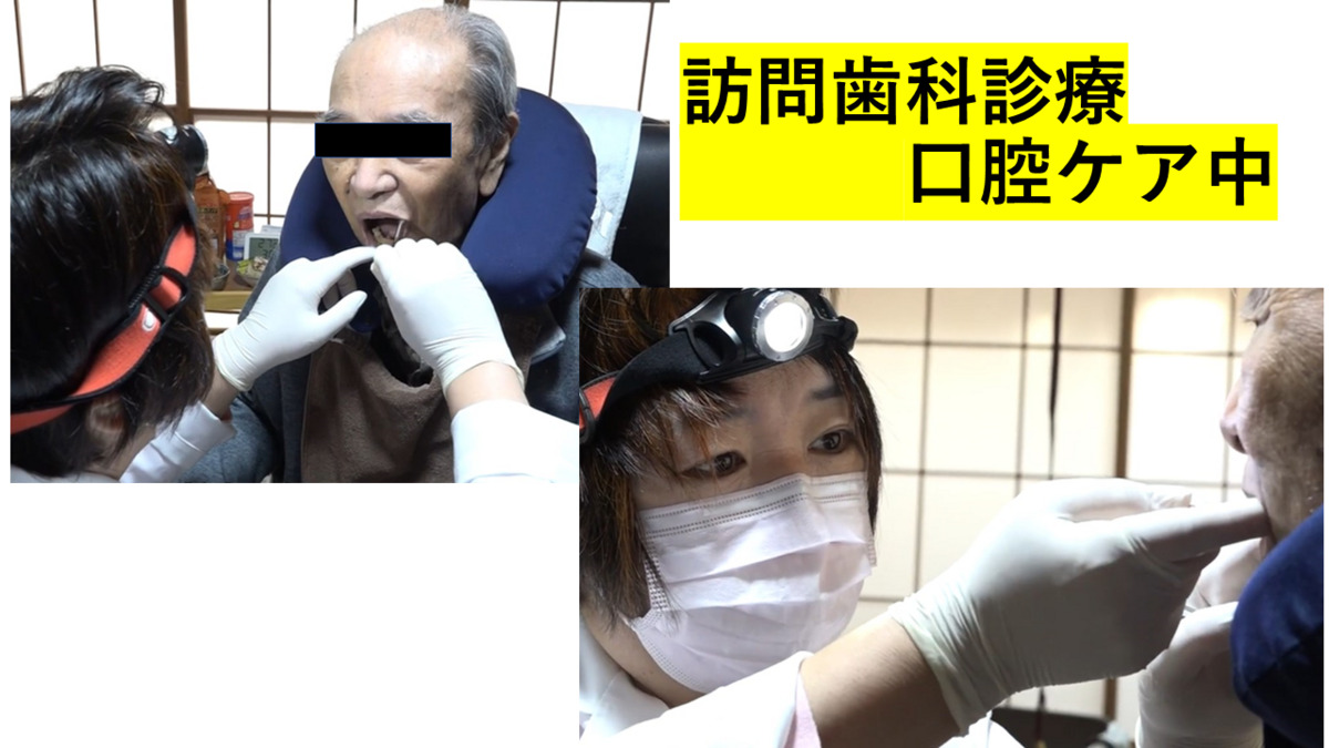 医療法人社団　ひまわり歯科の写真11枚目：訪問歯科診療
口腔ケア中です