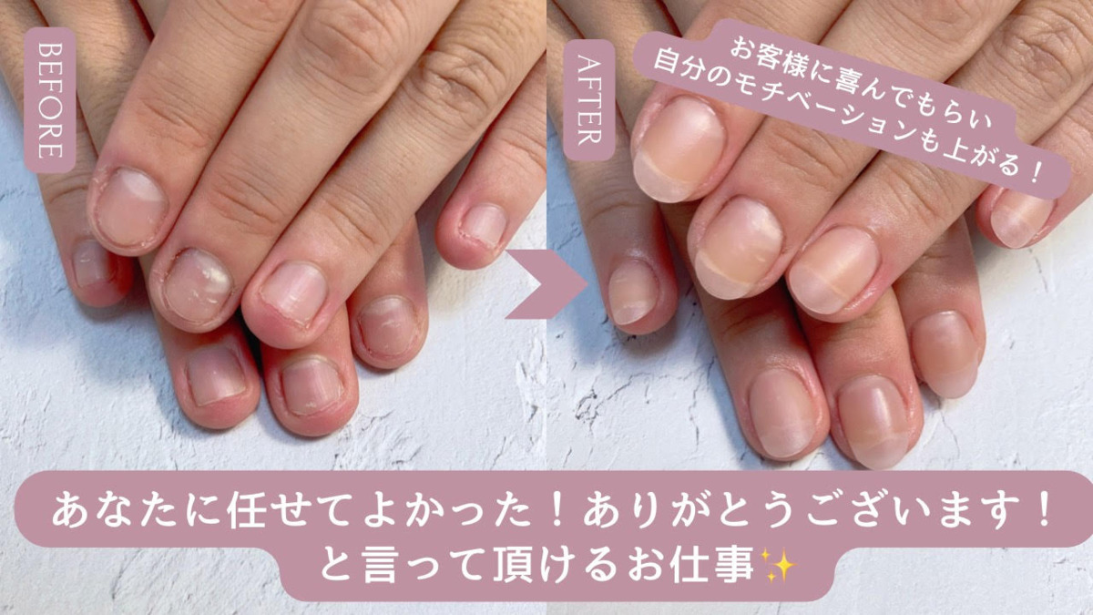 深爪矯正・自爪育成専門サロンNatuleaの写真4枚目：