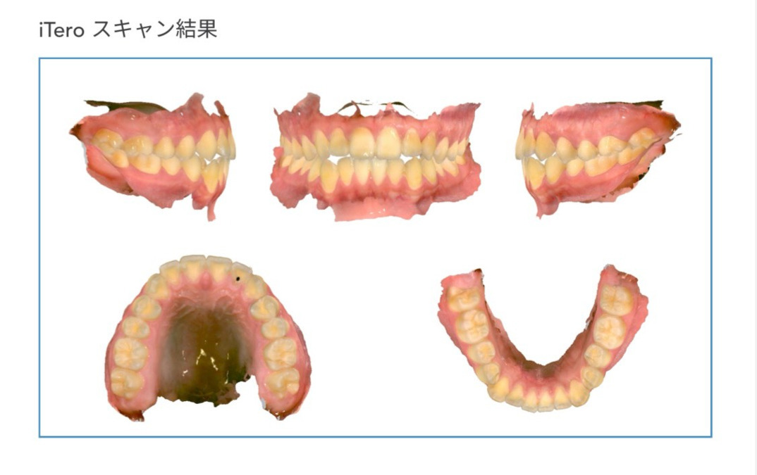 医療法人うえだ歯科クリニック（歯科衛生士の求人）の写真14枚目：