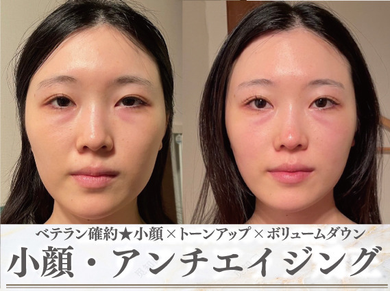  小顔矯正/左右差矯正/鎖骨・むくみ・骨盤矯正専門院　モアフェイス　池袋 の写真8枚目：