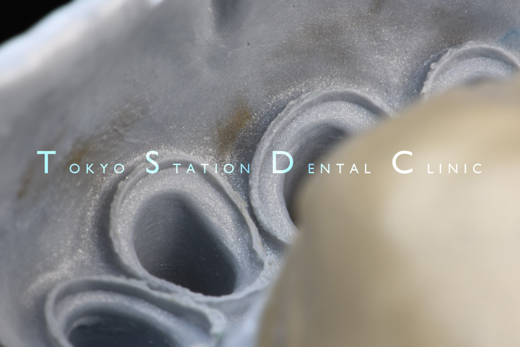 東京ステーション歯科クリニック(歯科医師の求人)の写真3枚目:印象採得の精度には徹底したこだわりを持って臨床を行っています。