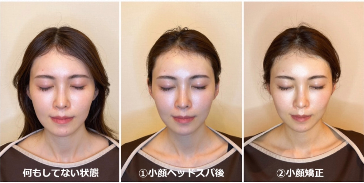 Bellega 小顔矯正/小顔ヘッドスパ/小顔リフト 恵比寿店【ベルガ】 【2025年07月12日オープン】の写真2枚目: