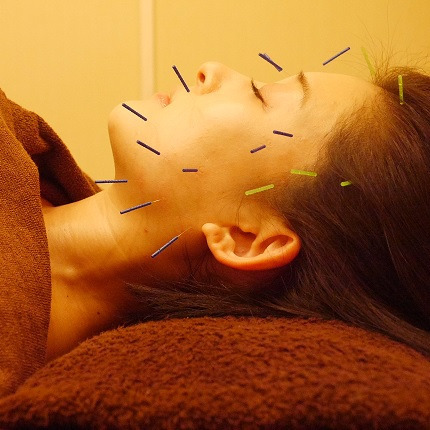 さくらリバース治療院 佐世保(柔道整復師の求人)の写真2枚目: