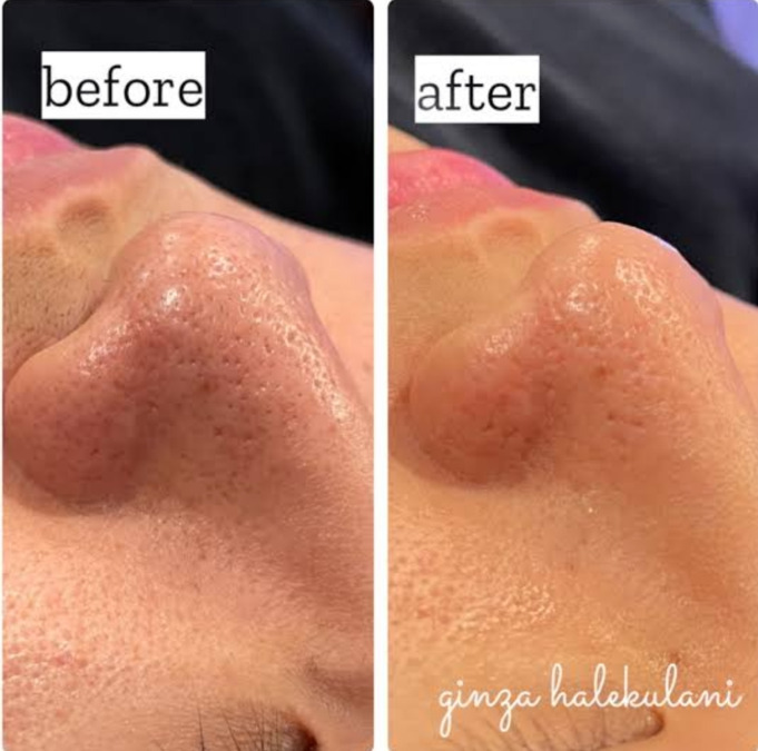 メンズサロン　Apolloの写真10枚目：