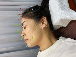いとう鍼灸整骨院の写真2枚目：