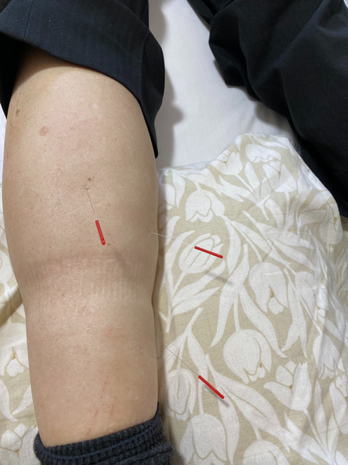 たかつき訪問治療院の写真6枚目：