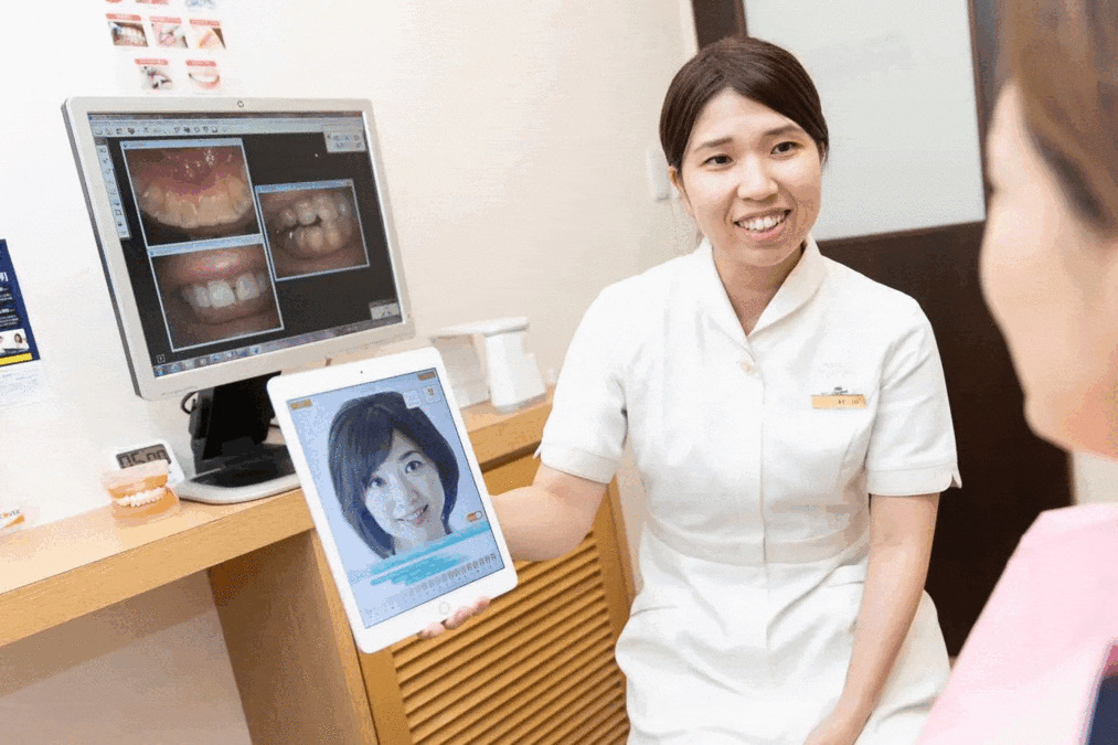 桝尾歯科クリニックの写真4枚目:ホワイトニングのシミュレーション