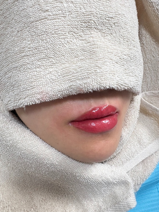 厚狭駅前歯科医院（歯科衛生士の求人）の写真5枚目：リップアートやホワイトニングなどの自費治療も行っております。