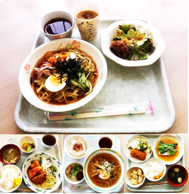 大阪府済生会茨木病院（言語聴覚士の求人）の写真7枚目：職員食堂は400円で食べることができます。