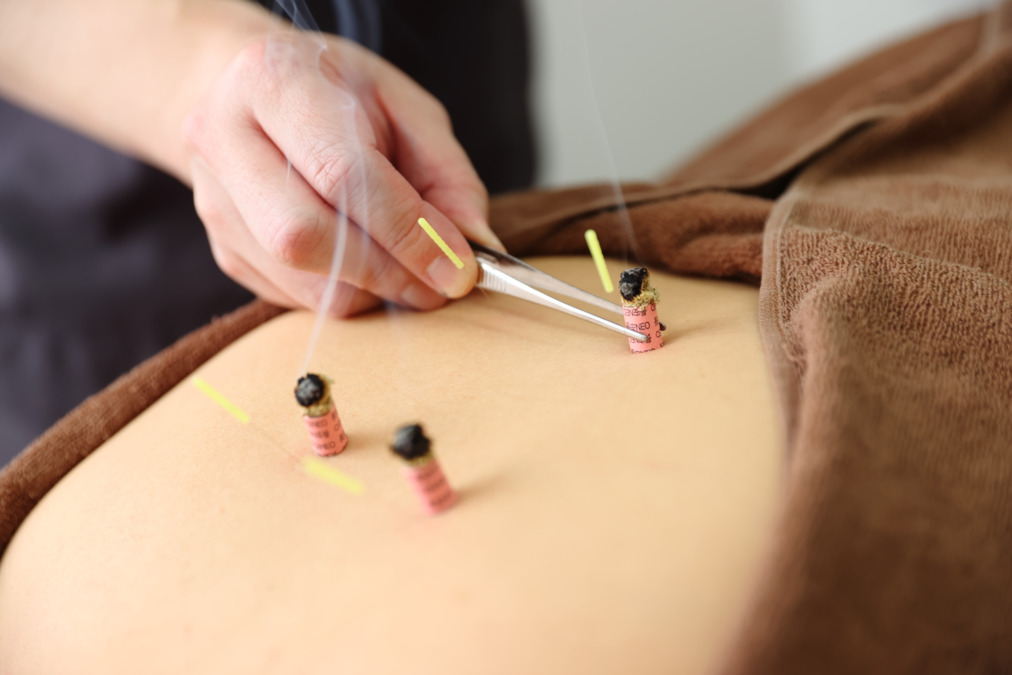 さかえ鍼灸治療院/整体院の写真6枚目：