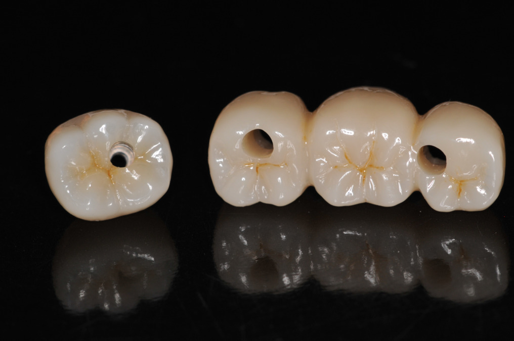 株式会社Levels(歯科技工士の求人)の写真5枚目: