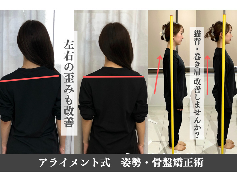 美容整体 AlignmentTOKYO 表参道【2024年11月オープン】（鍼灸師の求人）の写真8枚目：