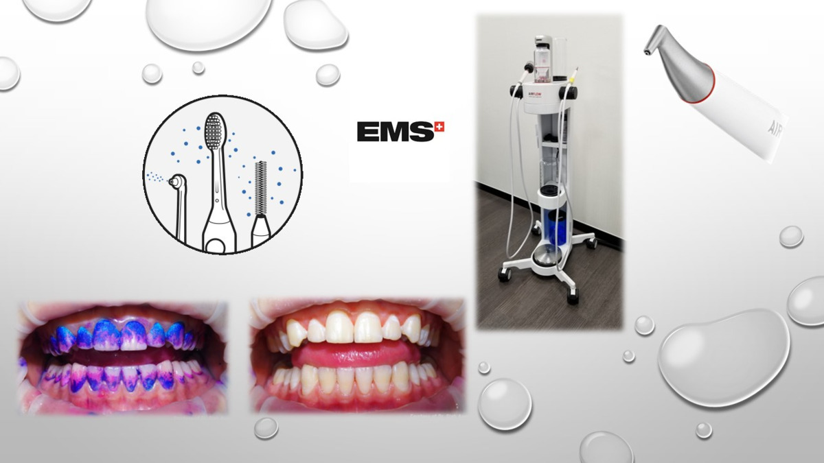 歯科クリニック中村（歯科衛生士の求人）の写真6枚目：☆GBTに使用EMS社製
　　　　　　　エアーフロー☆