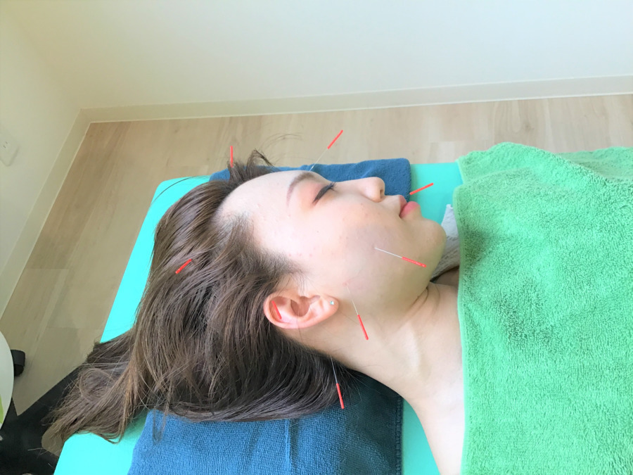 よつば鍼灸整骨院の写真18枚目：