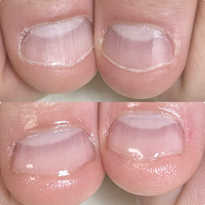 深爪矯正 爪悩み専門店グレースレディ(ネイリストの求人)の写真2枚目: