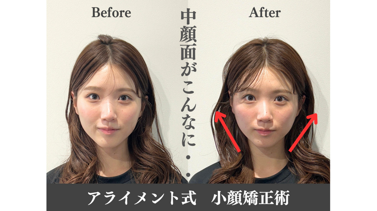 美容整体 AlignmentTOKYO 表参道【2024年11月オープン】（鍼灸師の求人）の写真4枚目：